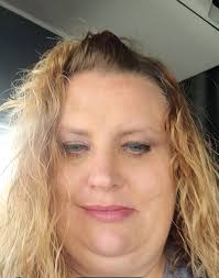 Bariatric surgery weight loss transformation