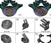 Schematic diagram of cage implantation position in the ALIF ...