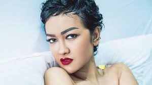 Begini Perkembangan Terakhir Kondisi Julia Perez