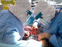 We did not find results for: A Maternity Ward During The Ebola Outbreak My Experience As An Ebola Fighter Blog Isglobal