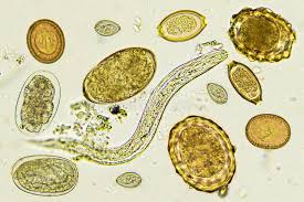We did not find results for: Melange Des Helminthes Ou Du Ver Parasite Dans Les Selles Image Stock Image Du Tenia Laboratoire 143060447