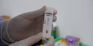 Ketahui Tes Cepat Rapid Test Apa Yang Harus Kamu Ketahui Satgas Penanganan Covid 19