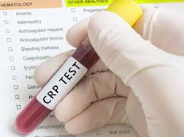 c reactive protein crp test high levels low levels and