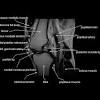 Any tightness or weakness in the muscles around the knee makes you prone. Https Encrypted Tbn0 Gstatic Com Images Q Tbn And9gcsxx8vfolcjtyfyluipaknd0tdacmsrn Eczuspg Neuy Ptvtt Usqp Cau