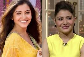 But the list we are showing you is of all time famous bollywood. Bollywood Actresses Who Have Used Lip Fillers To Enhance Their Lips And Improve Their Looks