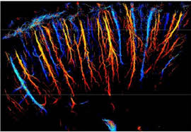 Utilisez une image à haute résolution lorsque vous souhaitez créer un mouvement panoramique ou faire un zoom avant ou arrière sur une image (par exemple, sur une carte ou une photographie. Les Ultrasons Revolutionnent L Imagerie Medicale A Tres Haute Resolution