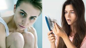 This is a clinical and hematological syndrome that occurs when there is a lack of iron in the body. 15 Anemia Symptoms To Never Ignore 7 Minute Read