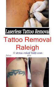 How Long Does It Take To Have A Tattoo Removed Tattoo Removal Las Vegas How Many Sessions To Remove A New Tatt Laser Tattoo Laser Tattoo Removal Tattoo Removal