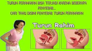 Jika ada, itu tanda peranakan/ rahim sudah berada terlalu ke. Ini Dia Ciri Dan Gejala Terjadinya Masalah Turun Peranakan Youtube