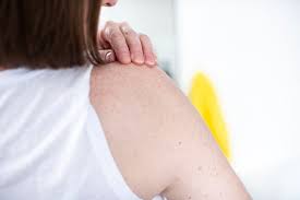 When it comes to suspicious spots on your skin, warning signs of cancer can include itching, bleeding, pain, rapid growth or significant changes in size or color over a few months and should be checked out by a dermatologist. Check For Signs Of Skin Cancer Cancer Council