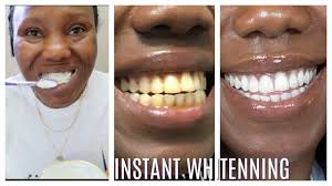 Pin On Dentistry