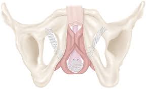 Advance Xp Male Sling System Features Benefits Boston Scientific