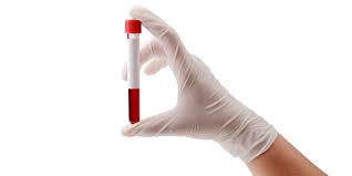 Testul Aslo Va Ajuta Sa Depistati Infectiile Streptococice