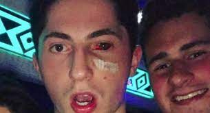 Zach werenski uudelleentwiittasi columbus blue jackets. Confirmed Blue Jackets Rookie Zach Werenski S Injured Eye Is Already Looking Better 1st Ohio Battery