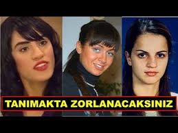 Gecirdikleri Estetik Operasyonlar Ile Adindan Soz Ettiren Bircok Unlumuz Bulunmaktadir Onceki Halleri Ile Simdiki Halleri Arasinda Dag Estetik Unluler Youtube