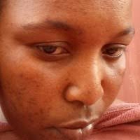 200+ "-matilde Lira" profiles