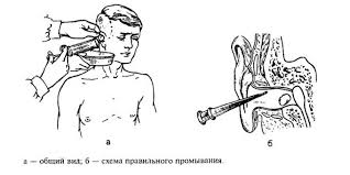 Det kan derfor være av. Hva Om Laid Oret
