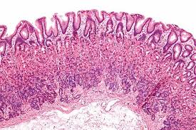 Does animal cell have mucous membrane. Mucous Membrane Mucosa Definition Function Examples