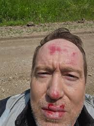 How long can I drive with a broken strut mount bolt?