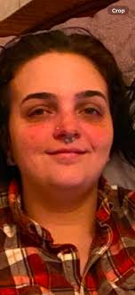 I had a discussion with an internal medicine doctor about Graves Disease  and RAI. This was a social situation, and I have known this doctor as a  friend since 1977. I discussed