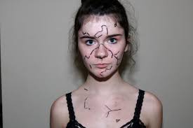 Skin deep: the painful path to a clear complexion