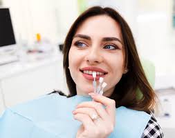 Porcelain and composite Veneers in Poway, CA