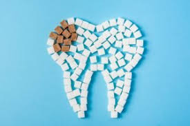 Sometimes this ache can come on suddenly, or it can happen as a. How To Tell If You Have A Cavity Parkdale Dental Centre