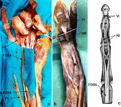 The vascular anatomy of the flexor digitorum profundus (fdp) tendon insertion is described by using a vascular injection and modified spalteholtz tissue clearing protocol in 36 human cadaver digits. Absence Of Flexor Digitorum Profundus Muscle And Variation Of Flexor Digitorum Superficialis Muscle In A Little Finger Two Case Reports Springerlink