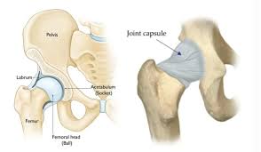 Image result for Hip Labral Tear