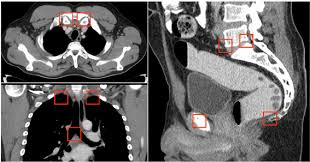 Check spelling or type a new query. Detected Ct Landmarks Examples Of Automatically Detected Anatomical Download Scientific Diagram