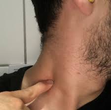 Knoten Im Hals Knoten Am Hals Ursachen Und Gegenmittel