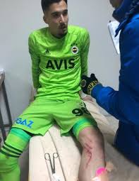 Altay bayındır haberlerine ulaşmak için sayfamızı takip edebilirsiniz. Super Lig International Das Linke Bein Von Altay Bayindir Gecmis Olsun Facebook