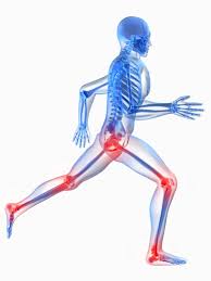 Image result for Running Injury