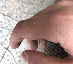 Weisse Punkte Auf Haut Durchblutungsstorung Stress Finger Durchblutung