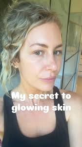 Ran across some old photos in my camera roll yesterday and 🤯!!!!! Forever  grateful for @_laurenfberry and @skin_pharm 😭, There’s nothing like  feeling confident in your skin without makeup. This is the ...