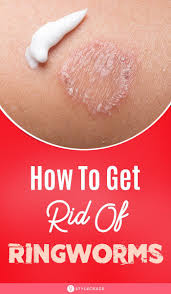 Scientists note that companies can make those claims, because their products do kill nearly all germs when tested on inanimate surfaces. Home Remedies For Ringworms 10 Ways To Treat The Symptoms Home Remedies For Ringworm Get Rid Of Ringworm Ringworm Remedies