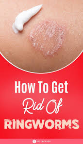 Scientists suspect hand sanitizer does, however, kill the coronavirus. Home Remedies For Ringworms 10 Ways To Treat The Symptoms Home Remedies For Ringworm Get Rid Of Ringworm Ringworm Remedies