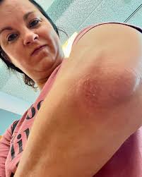 Another day, another...