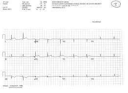 Image result for J Point