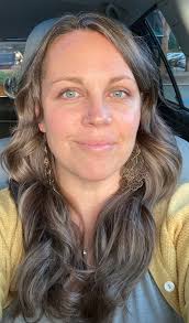 What to expect after MUA procedure?