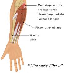 There are 20 forearm muscles which are arranged an anterior compartment that contains flexor muscles posterior compartment that contains extensor muscles. Treating Climber S Elbow Rehab And Prehab Protocol Training For Climbing By Eric Horst