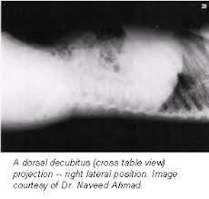 Looking for air in the abd to show if there is a perferation left lateral decubitus projection is most suitable. Dorsal And Lateral Decubitus Patient Positioning For Abdominal X Ray Exams