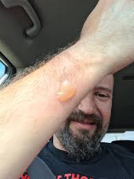 I don't know shit about keeping my sleeve from hiking up when I'm  administering 19 feet of justice from a scissor lift