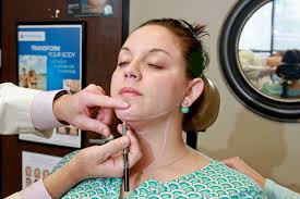 First FDA-approved fat cell injection does away with double chins