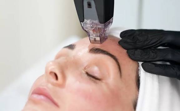 Morpheus 8 Skin Treatment in Dubai - The Nova Clinic