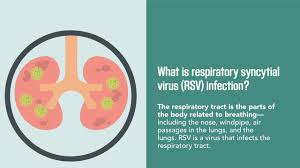 Respiratory syncytial virus (rsv) prevention guideline. Respiratory Syncytial Virus Rsv Infection The Causes And Diagnosis Merck Manual Quick Facts Youtube
