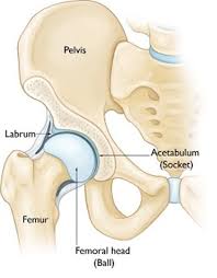 Image result for Hip Labral Tear
