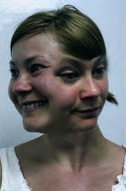 Ciclotimia – Wikipédia, a enciclopédia livre