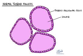 Nodular Thyroid Hyperplasia Of The Thyroid Gland Mypathologyreport Ca