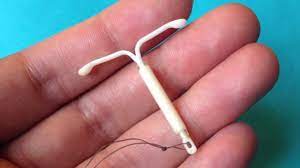 Steriletul este un dispozitiv intrauterin cu eficienta de 99% in prevenirea unei sarcini. Steriletul Totul Despre Aceasta Metoda Contraceptiva Mami Si Copilul